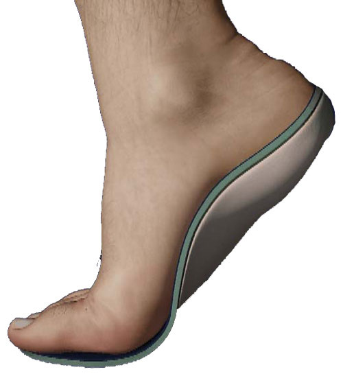 Insoles for foot on sale problems